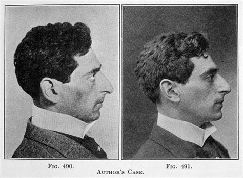 5 Incredible Images Of Plastic Surgery From The Past Europeana