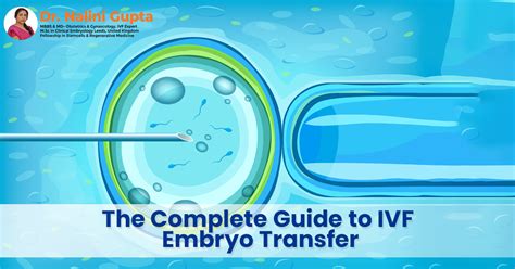 The Complete Guide to IVF Embryo TransferThe Complete Guide to IVF ...