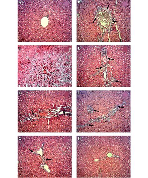 A Photomicrographs Showing Liver Sections Of Control B E Dm F Dm