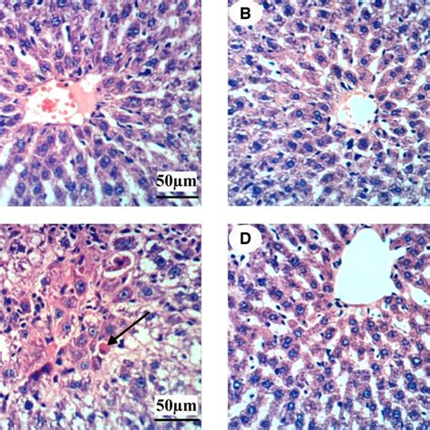 Histological Examination Of The Liver A Control Group Showed Normal Download Scientific