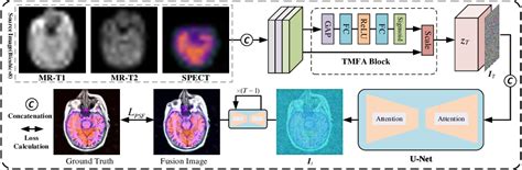 Figure From Simultaneous Tri Modal Medical Image Fusion And Super