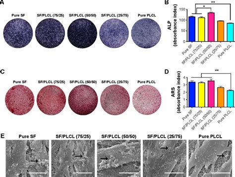 Figure 1 from Electrospun silk fibroin poly lactide co ε caprolactone