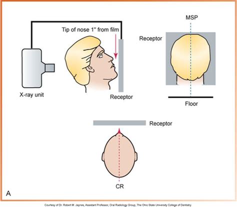 Dhy Radiology Ch Flashcards Quizlet