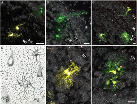 Immature Glia In The Adult OB AC Astroglia Exhibiting An