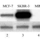 Expression Of The C Erbb Gene In Various Cell Lines Total Rnas From