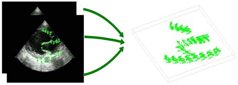 Illustration Of Echo Feature Points Extracted From Echo Video Of The