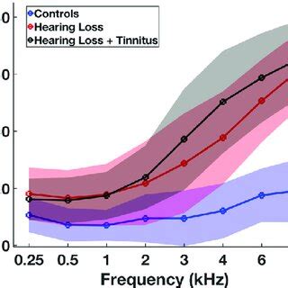 Hearing Thresholds For The Three Groups With Their Respective Sds