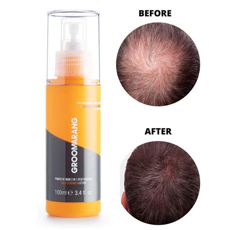 Groomarang Loci N De Prevenci N De La P Rdida De Cabello Power Of Man