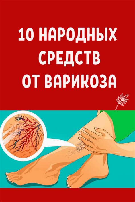 10 прекрасных средств от варикоза...