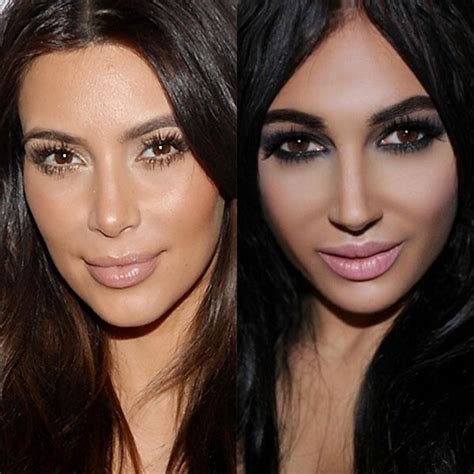 Kim Kardashian Plastic Surgery Before And After