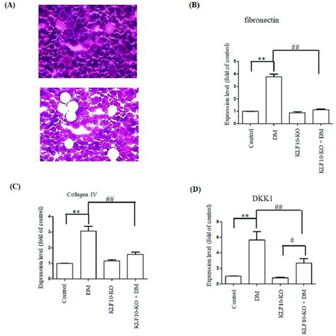 Repression Of Fibrosis Related Gene Expression In KLF10 Knockout