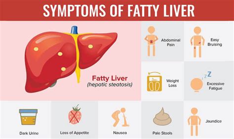 Fatty Liver Disease Understanding Its Types And Treatment Vaidam Health