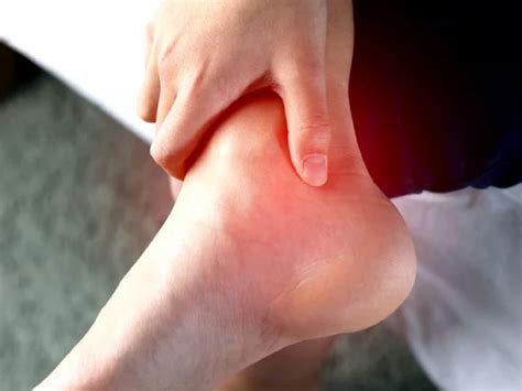 Gout đau cổ chân Nguyên nhân Triệu chứng và Giải Pháp Điều Trị Hiệu Quả