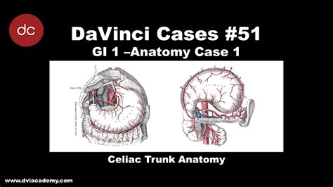 Celiac Trunk Anatomy Case DaVinciCases Gastrointestinal 1 Anatomy