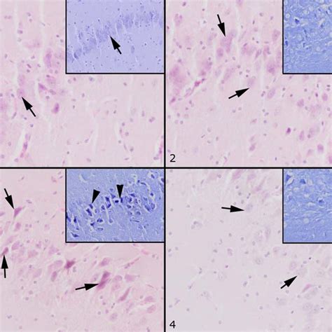 -1) Photomicrographs of hippocampus in control group mice (The normal ... 