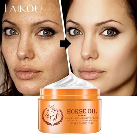 LAIKOU Face Moisturizers, Moisturizing Cream For Oily Skin Anti Freckle ...