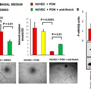 The Effect Of Ponatinib And Notch Signaling Inhibition On Tube