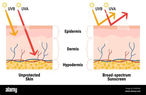 Uv Penetration Into The Layers Of The Skin Infographic Of Sunscreen