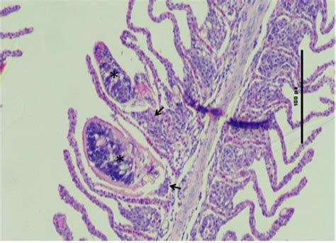 Histology Of The Gills From The Farmed Nile Tilapia Infected With