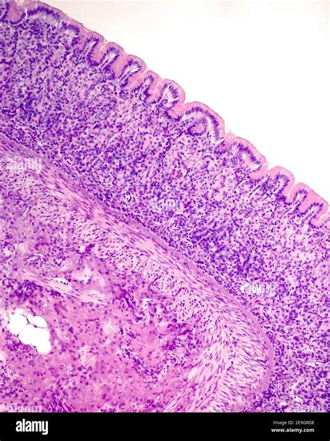 The Mucosa Layer Shows Surface Mucous Epithelium Gastric Pits Fundic