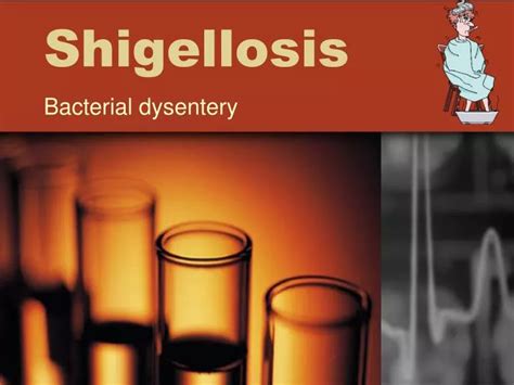 Ppt Shigellosis Powerpoint Presentation Free Download Id1019191