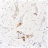 Pathology Outlines Cytokeratin Ck K