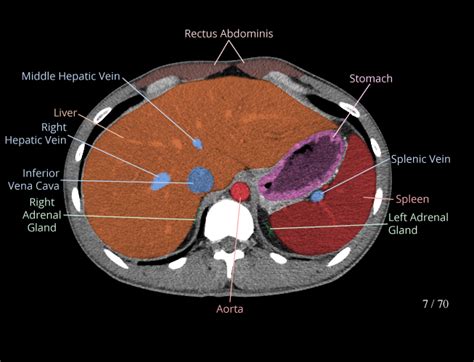 Abdomen And Pelvis Normal Anatomy E Anatomy 41 OFF