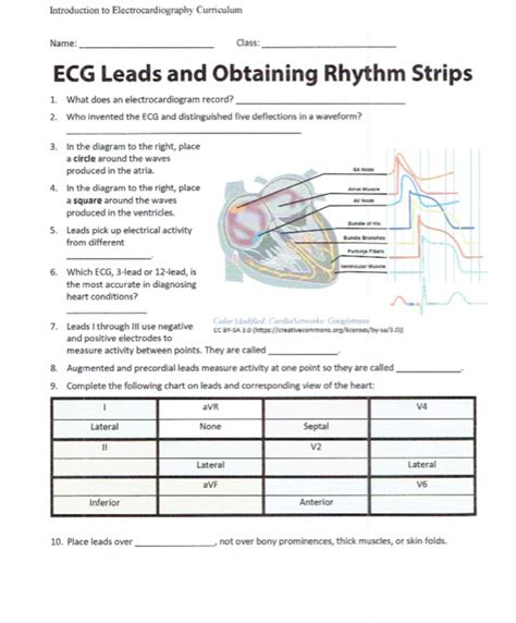 Solved Introduction To Electrocardiography Curriculum Name Chegg