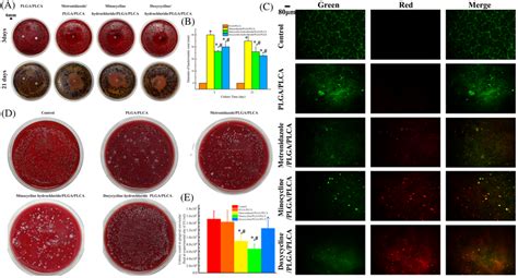 A Zone Of Inhibition Zoi Assay Of Antibioticloaded Plga Plca