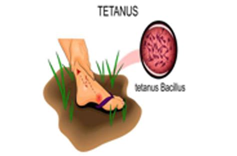 Tetanus Causes