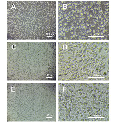 Phase Contrast Morphology Of LSA And LPS Treated Macrophages