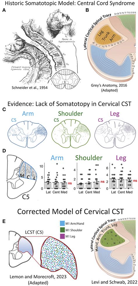 Frontiers Pathophysiology And Surgical Decision Making In Central