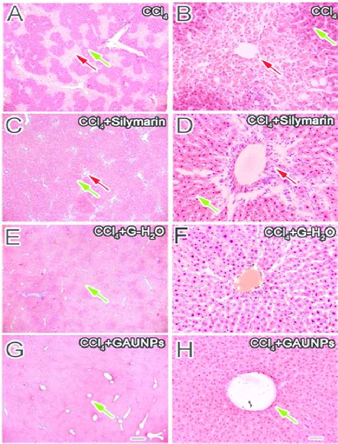 Histological Analysis Of Acute Liver Injury Induced By Ccl 4