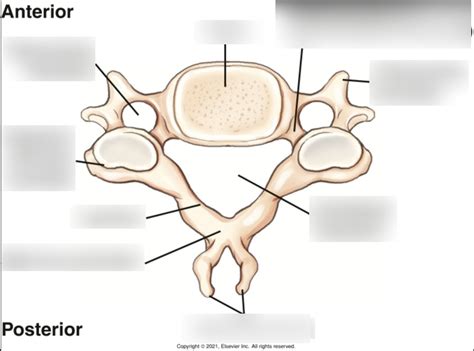 Typical C3 C6 Cervical Vertebra Superior View Labeled Diagram Quizlet