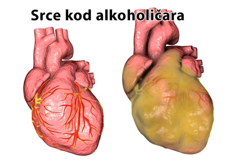 Les Cons Quences De Lalcool Traitement La Clinique Dr Vorobjev