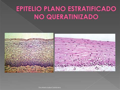 EPITELIO PLANO ESTRATIFICADO PARAQUERATINIZADO Ppt Descargar