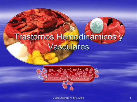 Trastornos HemodináMicos Y Vasculares PPT