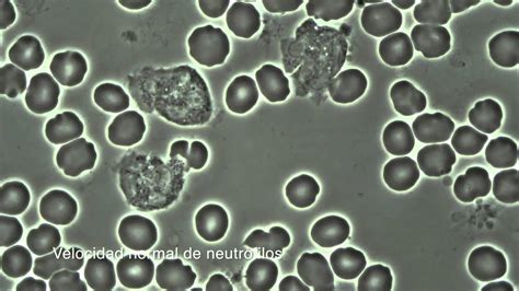 Microscopia De Contraste De Fases Loftmoli