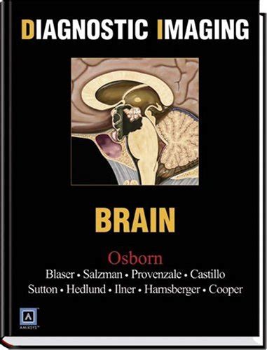 『diagnostic Imaging Brain』｜感想・レビュー 読書メーター