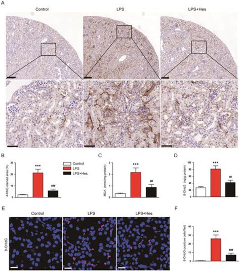 Antioxidant Antiapoptotic And Anti Inflammatory Effects Of Hesperetin