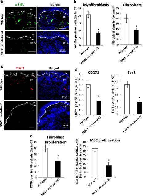 Keratinocyte Specific Foxo Deletion Reduces Fibroblast And Msc