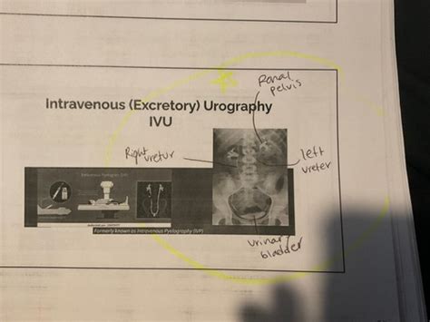 Rad Urinary System Flashcards Quizlet