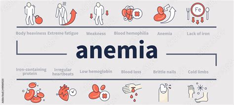 Anemia Disease Infographics Disease Symptoms Layout Info Chart Banner Testing Prevention Of