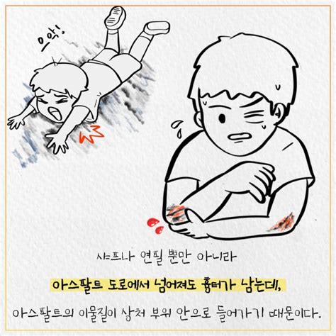 60초 건강 샤프심에 찔리면 정말 점이 생길까 헬스컨슈머