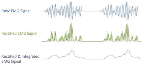 EMG signal at different stages of processing | Download Scientific Diagram