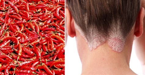 Capsaicin Health Benefits: Pain Relief, Weight Loss And Much More!