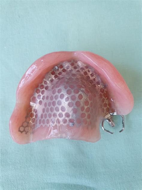 Partial Dentures Plates Northland Prosthodontics Northland