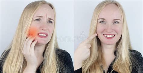 Antes E Depois à Esquerda a Mulher Indica Dor Nos Dentes E à Direita