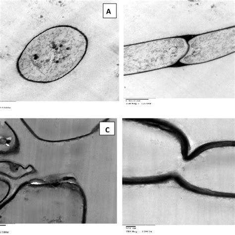 Transmission Electron Micrographs Showing Transverse Section Of