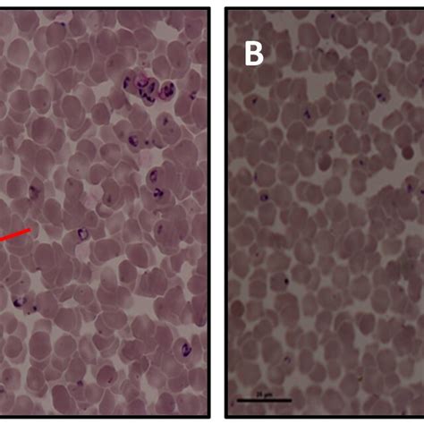 Photomicrograph Of Giemsa Stained Blood Smear In Equine Piroplasmosis